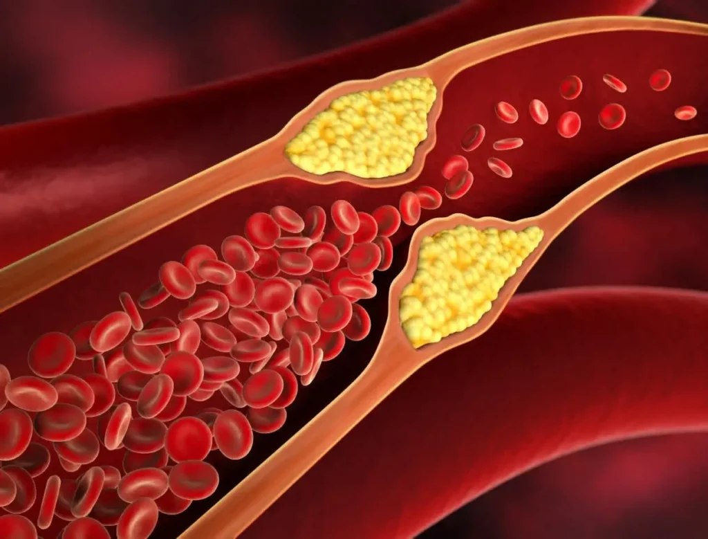 Vitalmindflow LDL Cholesterol